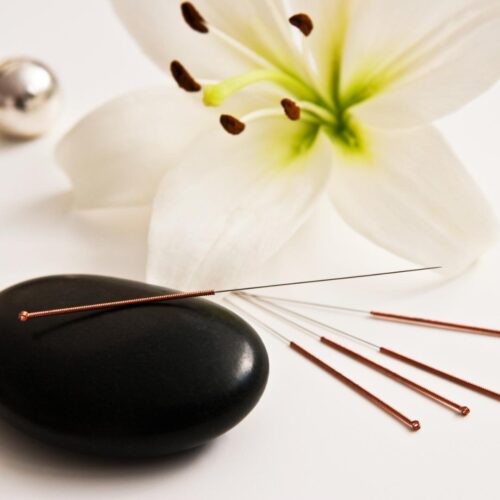 acupuncture acupuncture